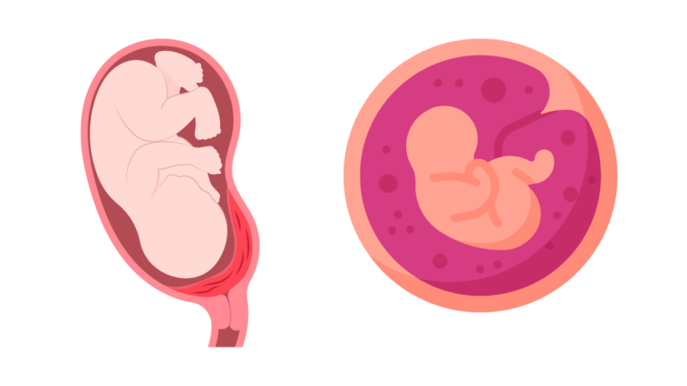 Low-Lying Placenta: Understanding the Risks & Precautions