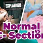 Normal Delivery vs Cesarean Section: Understanding the Difference