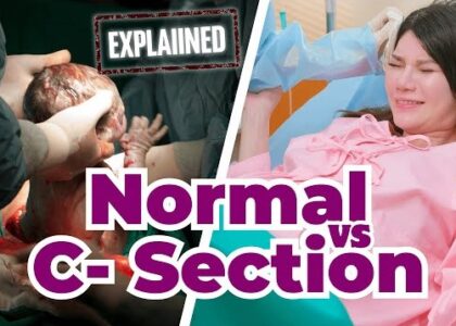 Normal Delivery vs Cesarean Section: Understanding the Difference