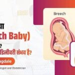 प्रेगनेंसी में बच्चा उल्टा (Breech Baby) है? जानें कारण, सीधा करने के उपाय और डिलीवरी के सही विकल्प।