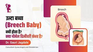 प्रेगनेंसी में बच्चा उल्टा (Breech Baby) है? जानें कारण, सीधा करने के उपाय और डिलीवरी के सही विकल्प।