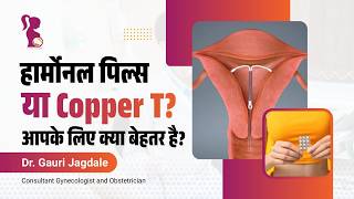 कॉपर-टी (Copper-T) क्या है? फायदे, नुकसान और पूरी जानकारी।