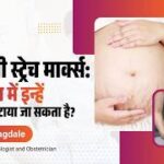 प्रेग्नेंसी स्ट्रेच मार्क्स: कारण, बचाव और आसान घरेलू उपाय