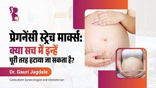प्रेगनेंसी स्ट्रेच मार्क्स: कारण, बचाव और आसान घरेलू उपाय