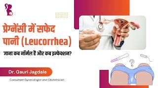 प्रेगनेंसी में White Discharge: कब नॉर्मल, कब खतरा?